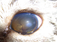 図9 眼内腫瘍の続発性緑内障