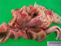 腸管のリンパ腫